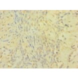 Immunohistochemistry - Metalloproteinase inhibitor 1 Polyclonal Antibody from Signalway Antibody - Antibodies.com