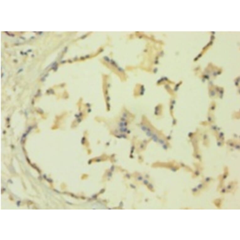 Immunohistochemistry - Metalloproteinase inhibitor 1 Polyclonal Antibody from Signalway Antibody - Antibodies.com