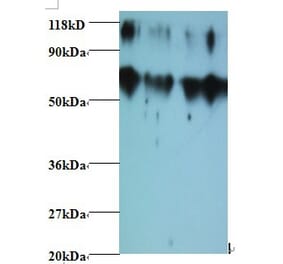 Metalloproteinase inhibitor 2 Polyclonal Antibody from Signalway Antibody (42482) - Antibodies.com