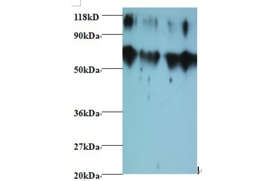 Metalloproteinase inhibitor 2 Polyclonal Antibody from Signalway Antibody (42482) - Antibodies.com