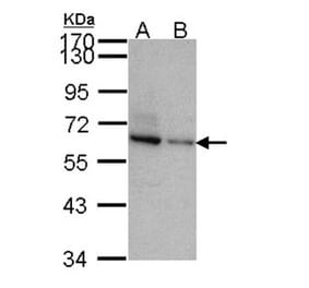 TOM1-like protein 2 antibody from Signalway Antibody (22411) - Antibodies.com