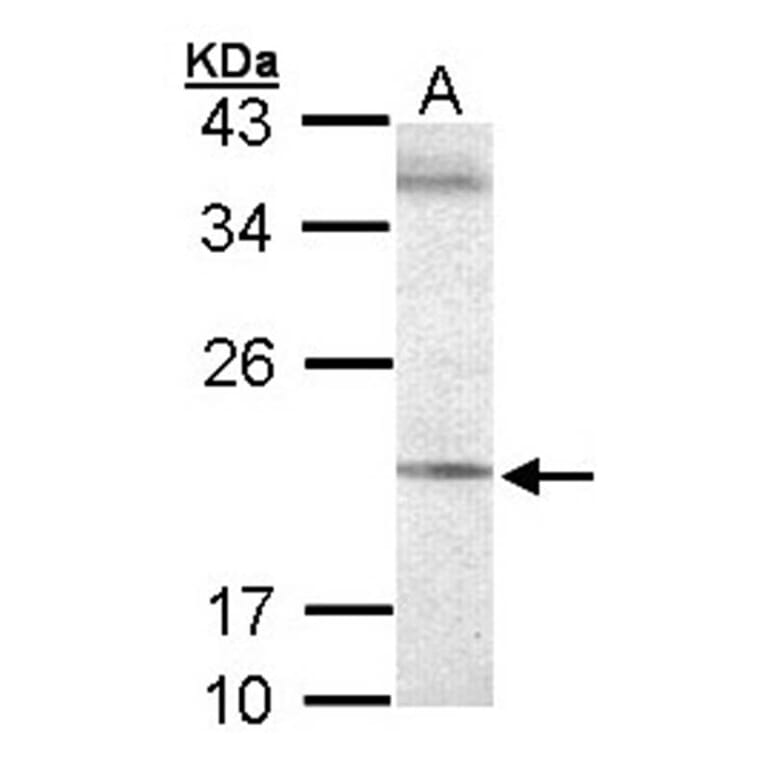 Sec61 gamma subunit antibody from Signalway Antibody (23120) - Antibodies.com