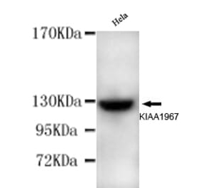 KIAA1967 Monoclonal Antibody from Signalway Antibody (27008) - Antibodies.com