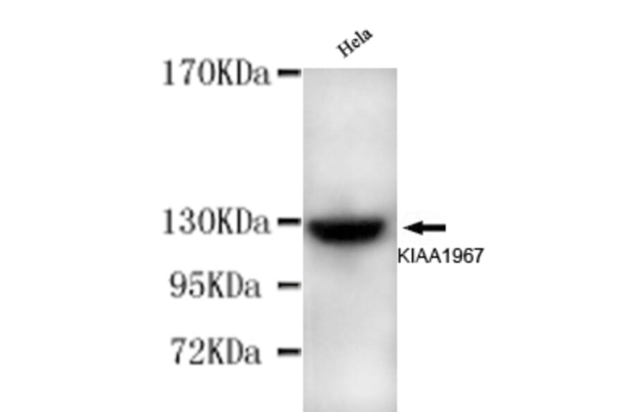 KIAA1967 Monoclonal Antibody from Signalway Antibody (27008) - Antibodies.com