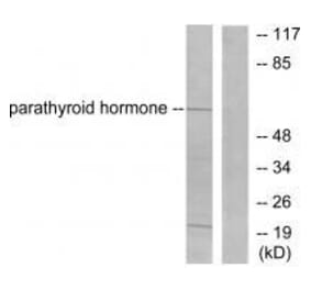 Western blot - Parathyroid Hormone Antibody from Signalway Antibody (33463) - Antibodies.com
