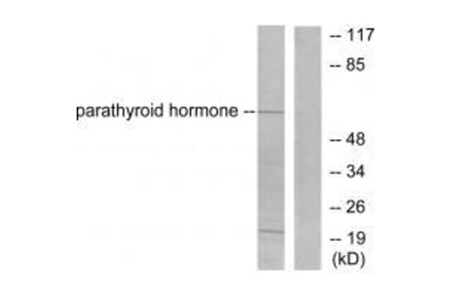 Western blot - Parathyroid Hormone Antibody from Signalway Antibody (33463) - Antibodies.com