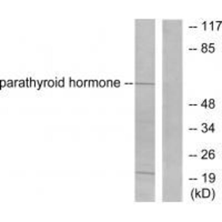Western blot - Parathyroid Hormone Antibody from Signalway Antibody (33463) - Antibodies.com