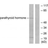 Western blot - Parathyroid Hormone Antibody from Signalway Antibody (33463) - Antibodies.com