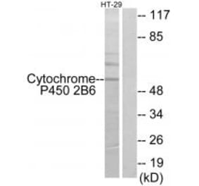 Western blot - Cytochrome P450 2B6 Antibody from Signalway Antibody (34234) - Antibodies.com