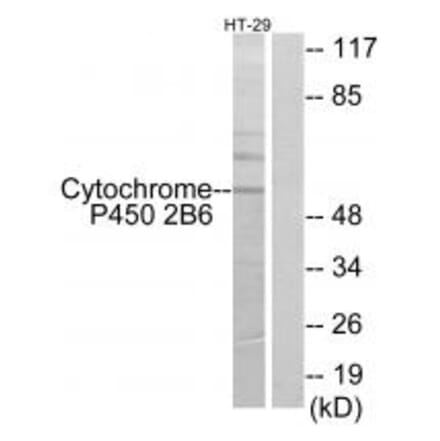 Western blot - Cytochrome P450 2B6 Antibody from Signalway Antibody (34234) - Antibodies.com