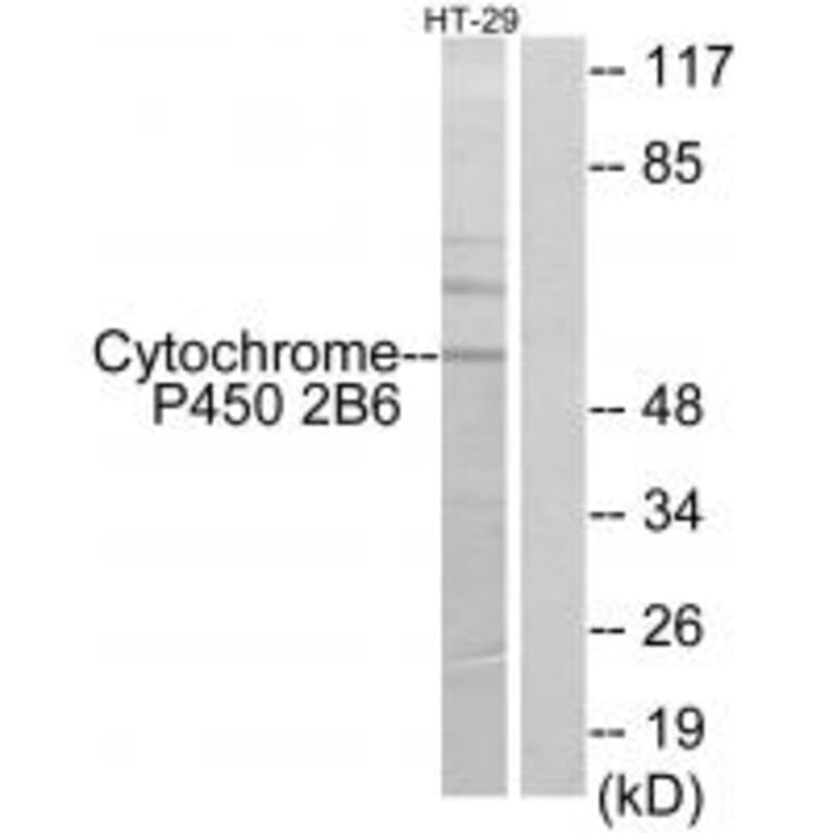 Western blot - Cytochrome P450 2B6 Antibody from Signalway Antibody (34234) - Antibodies.com