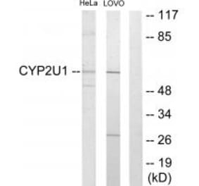 Western blot - Cytochrome P450 2U1 Antibody from Signalway Antibody (34240) - Antibodies.com