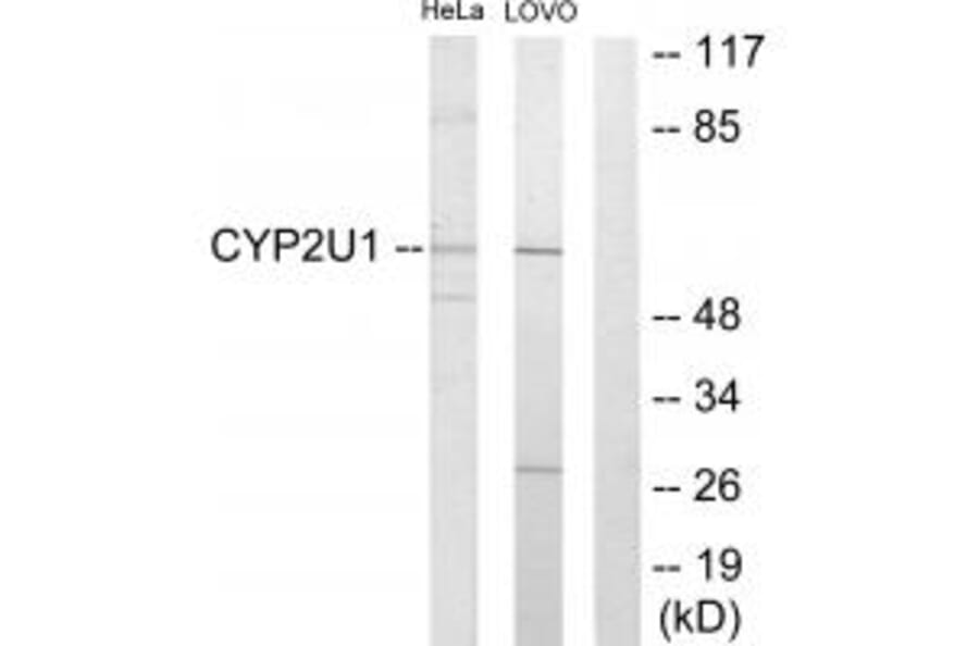 Western blot - Cytochrome P450 2U1 Antibody from Signalway Antibody (34240) - Antibodies.com