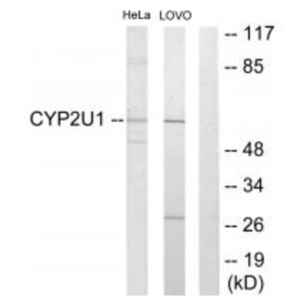 Western blot - Cytochrome P450 2U1 Antibody from Signalway Antibody (34240) - Antibodies.com