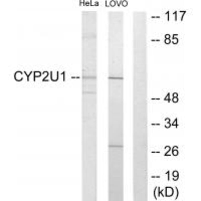 Western blot - Cytochrome P450 2U1 Antibody from Signalway Antibody (34240) - Antibodies.com
