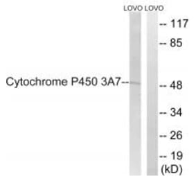 Western blot - Cytochrome P450 3A7 Antibody from Signalway Antibody (35259) - Antibodies.com