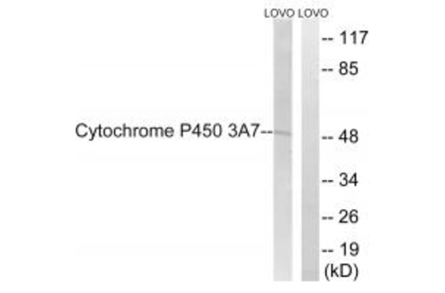 Western blot - Cytochrome P450 3A7 Antibody from Signalway Antibody (35259) - Antibodies.com