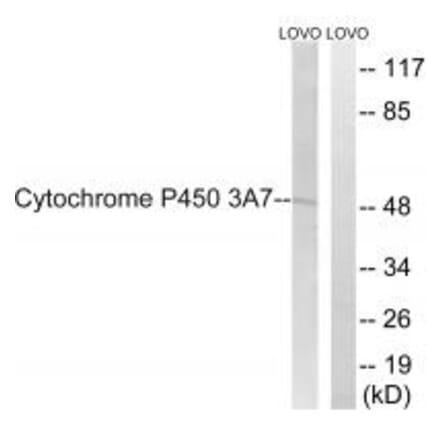 Western blot - Cytochrome P450 3A7 Antibody from Signalway Antibody (35259) - Antibodies.com