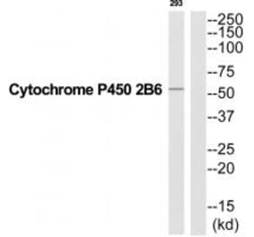 Western blot - Cytochrome P450 2B6 Antibody from Signalway Antibody (35270) - Antibodies.com