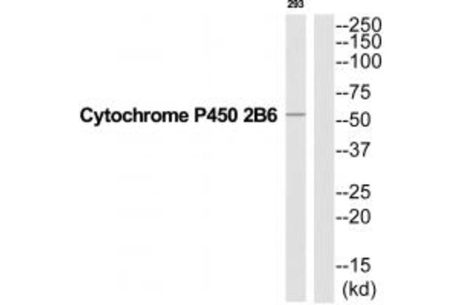 Western blot - Cytochrome P450 2B6 Antibody from Signalway Antibody (35270) - Antibodies.com