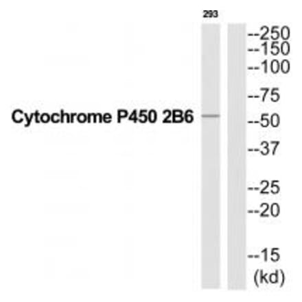 Western blot - Cytochrome P450 2B6 Antibody from Signalway Antibody (35270) - Antibodies.com