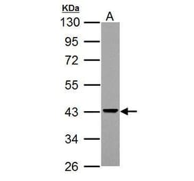 Adenosine Deaminase Antibody from Signalway Antibody (35369) - Antibodies.com