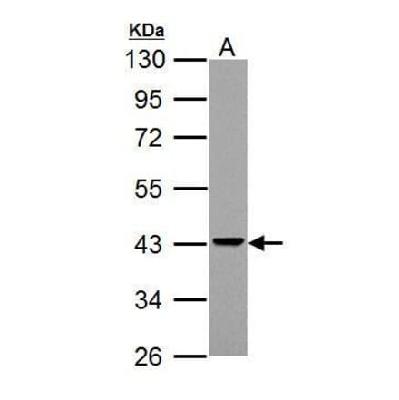 Adenosine Deaminase Antibody from Signalway Antibody (35369) - Antibodies.com