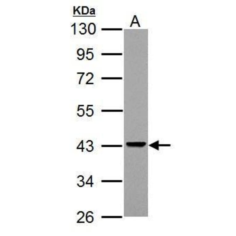 Adenosine Deaminase Antibody from Signalway Antibody (35369) - Antibodies.com