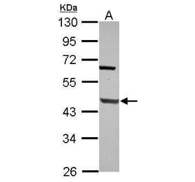 DNA Polymerase beta Antibody from Signalway Antibody (35404) - Antibodies.com