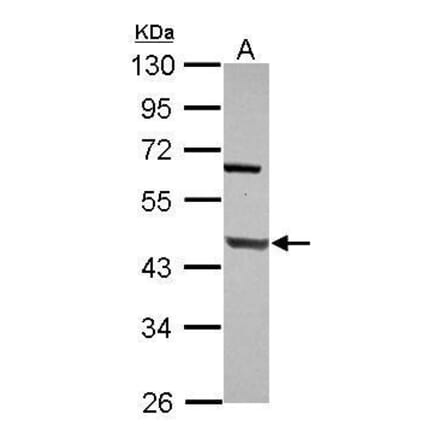 DNA Polymerase beta Antibody from Signalway Antibody (35404) - Antibodies.com