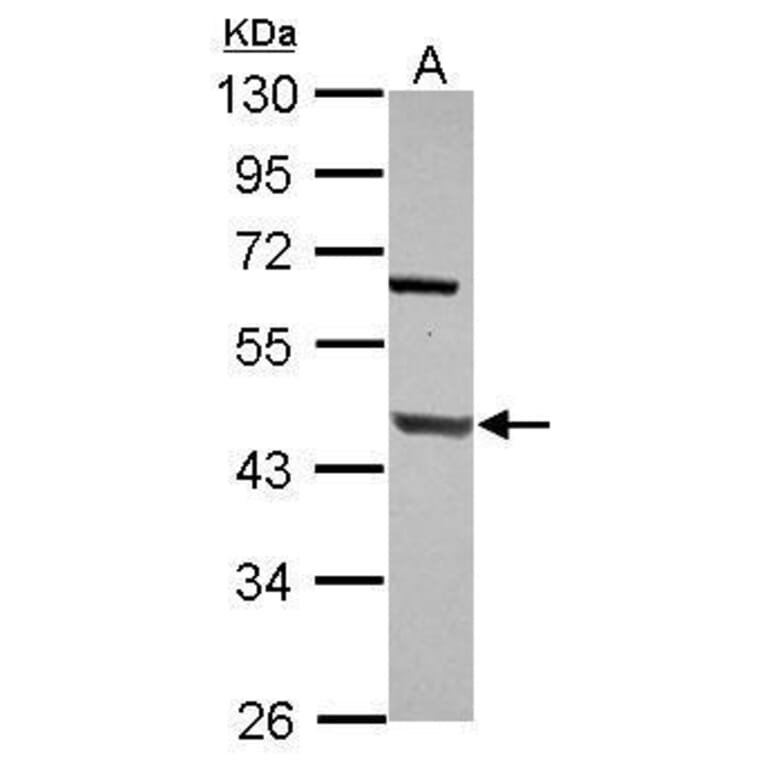 DNA Polymerase beta Antibody from Signalway Antibody (35404) - Antibodies.com