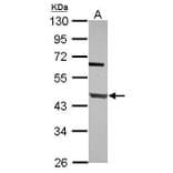 DNA Polymerase beta Antibody from Signalway Antibody (35404) - Antibodies.com