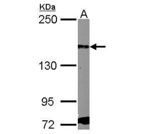 PDGF Receptor alpha Antibody from Signalway Antibody (35451) - Antibodies.com