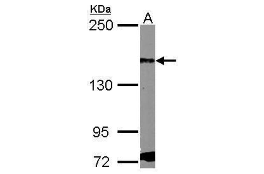 PDGF Receptor alpha Antibody from Signalway Antibody (35451) - Antibodies.com