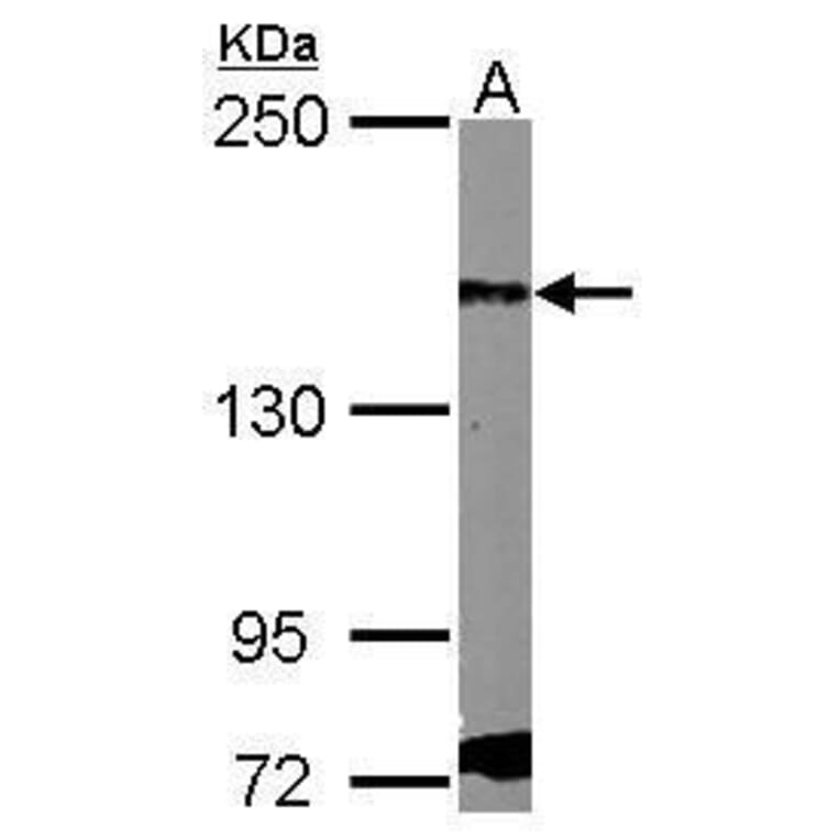 PDGF Receptor alpha Antibody from Signalway Antibody (35451) - Antibodies.com