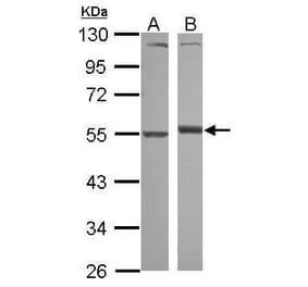 Alpha 1 antitrypsin Antibody from Signalway Antibody (35507) - Antibodies.com