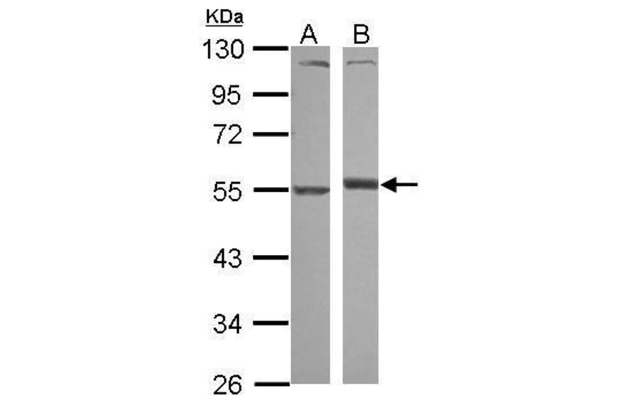 Alpha 1 antitrypsin Antibody from Signalway Antibody (35507) - Antibodies.com
