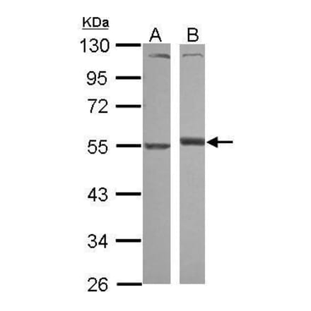 Alpha 1 antitrypsin Antibody from Signalway Antibody (35507) - Antibodies.com