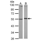 Alpha 1 antitrypsin Antibody from Signalway Antibody (35507) - Antibodies.com