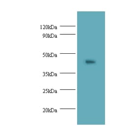 Napsin-A Polyclonal Antibody from Signalway Antibody (42541) - Antibodies.com