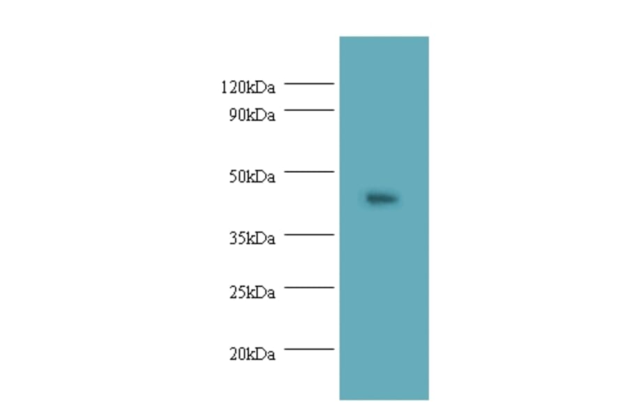 Napsin-A Polyclonal Antibody from Signalway Antibody (42541) - Antibodies.com