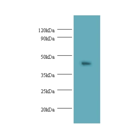 Napsin-A Polyclonal Antibody from Signalway Antibody (42541) - Antibodies.com