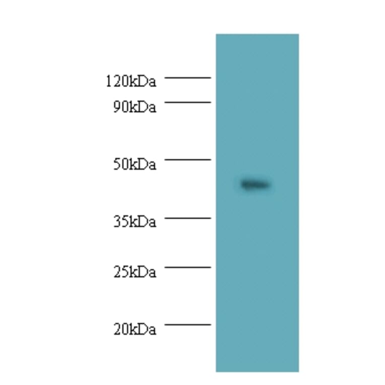 Napsin-A Polyclonal Antibody from Signalway Antibody (42541) - Antibodies.com