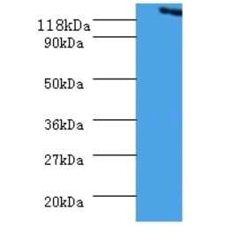 Vinculin Polyclonal Antibody from Signalway Antibody (42573) - Antibodies.com