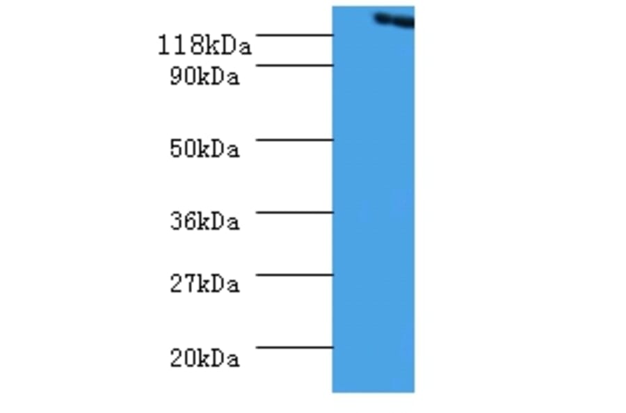 Vinculin Polyclonal Antibody from Signalway Antibody (42573) - Antibodies.com