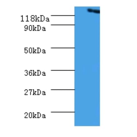 Vinculin Polyclonal Antibody from Signalway Antibody (42573) - Antibodies.com