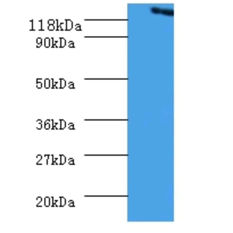 Vinculin Polyclonal Antibody from Signalway Antibody (42573) - Antibodies.com