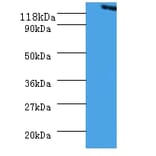 Vinculin Polyclonal Antibody from Signalway Antibody (42573) - Antibodies.com