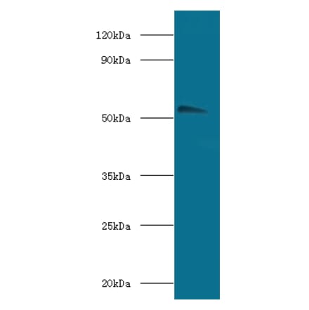 Acetylcholine receptor subunit alpha Polyclonal Antibody from Signalway Antibody (42123) - Antibodies.com