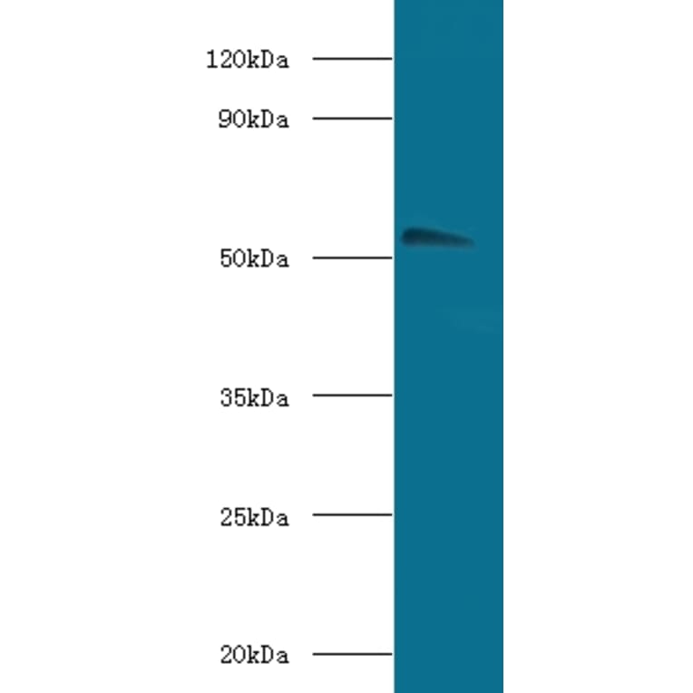 Acetylcholine receptor subunit alpha Polyclonal Antibody from Signalway Antibody (42123) - Antibodies.com